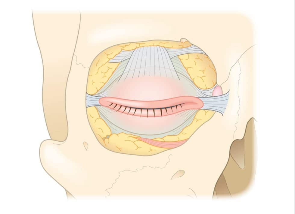 Delicate Eyelid Anatomy from Dr Julian DeSilva's Blepharoplasty Book