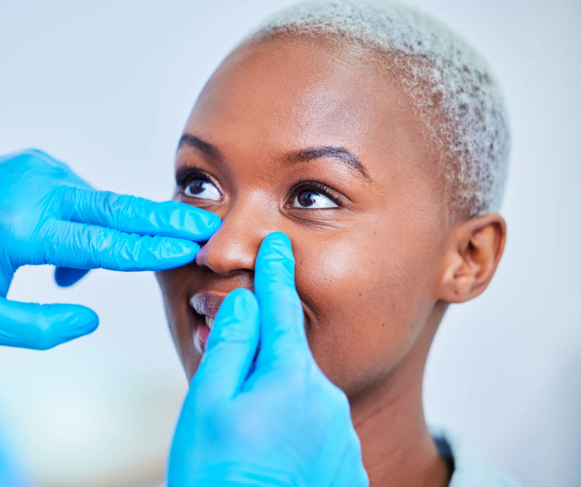 Ethnic Rhinoplasty Consultation With Female Patient