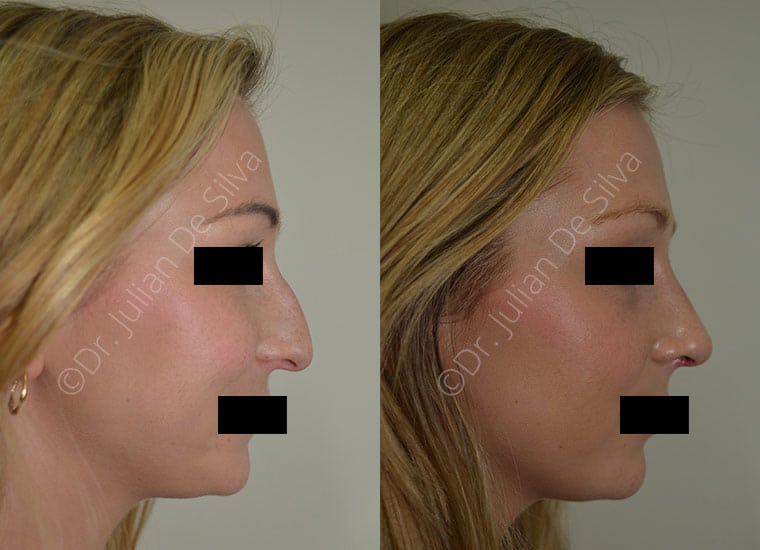 Cmp Gallery Slider image 4