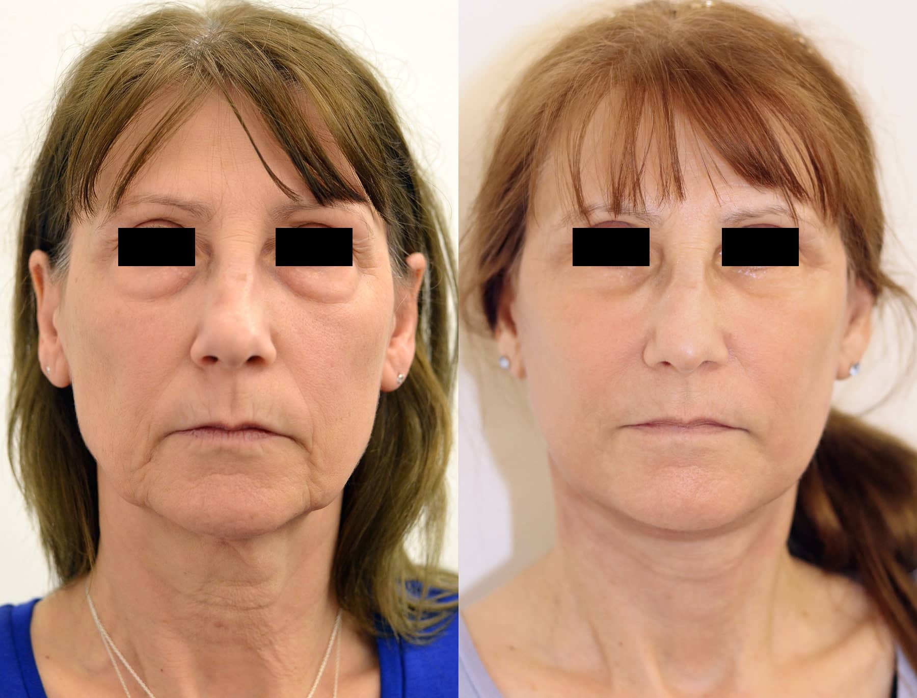 Cmp Gallery Slider image 6