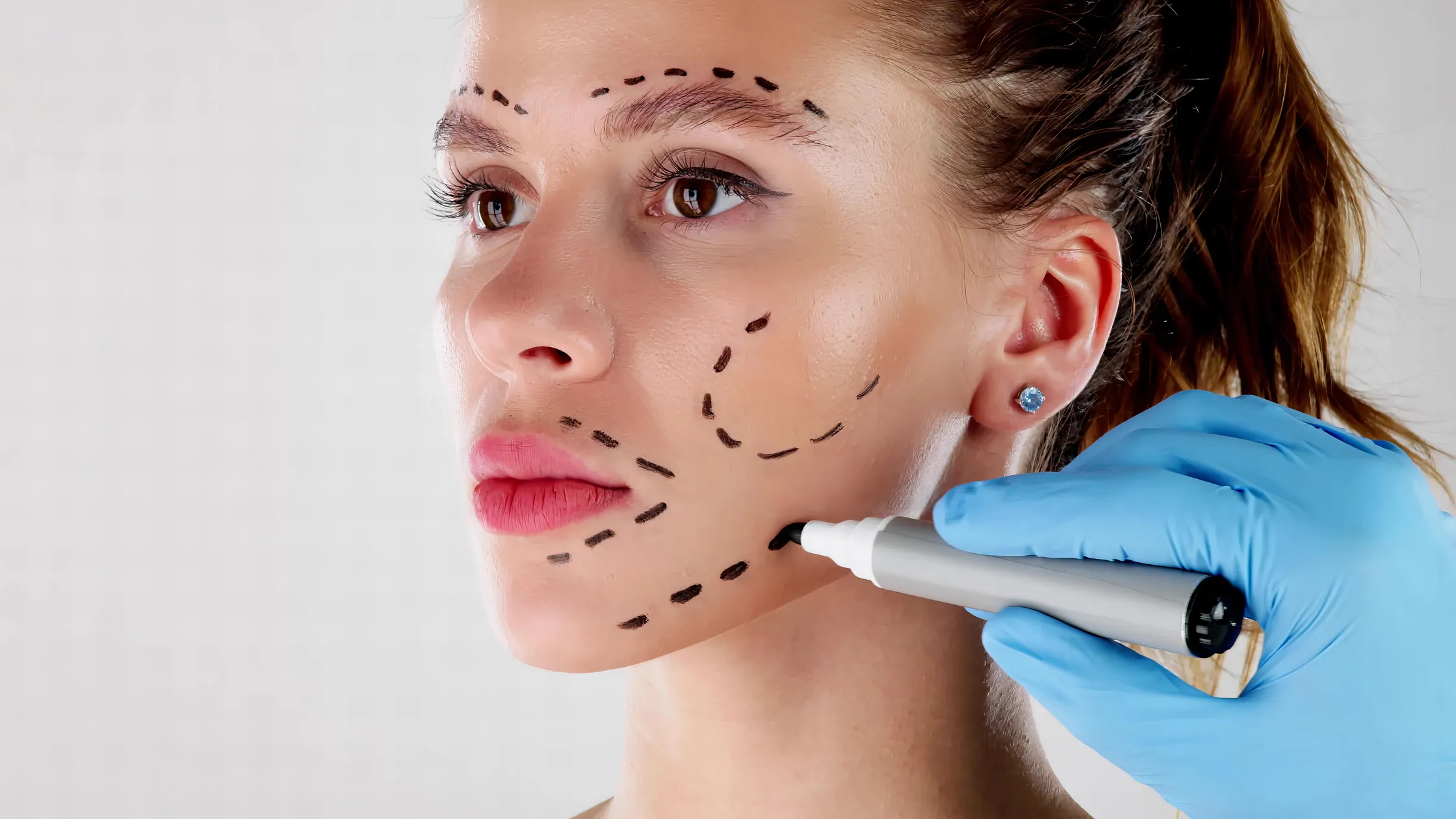 Considering a Future Facelift? Treatments to Think Carefully About Today