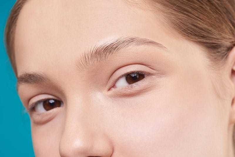 Before and After Blepharoplasty: What You Need to Know