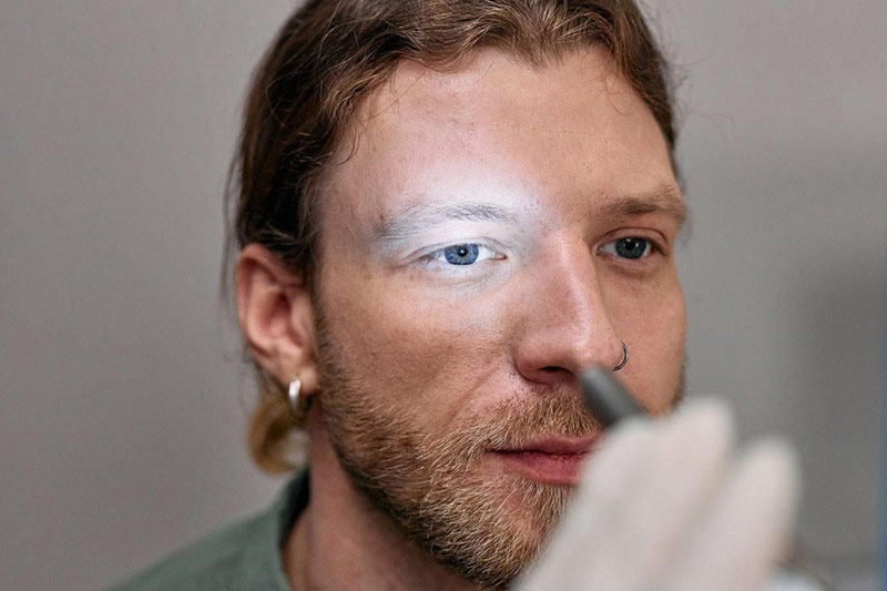 Before Eye-Lift Surgery — male patient