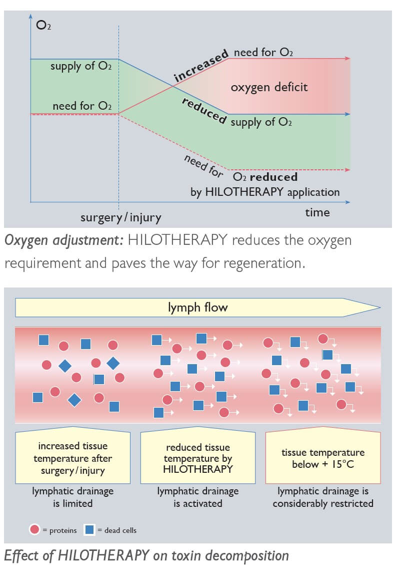 Oxygen adjustment — hilotherapy