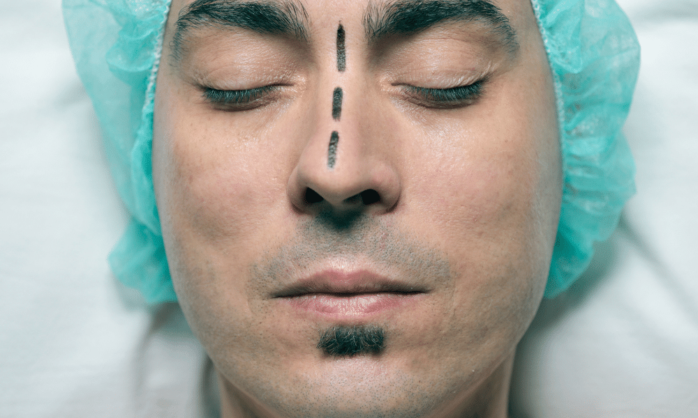 A functional rhinoplasty helps fix nose blockage and breathing issues.