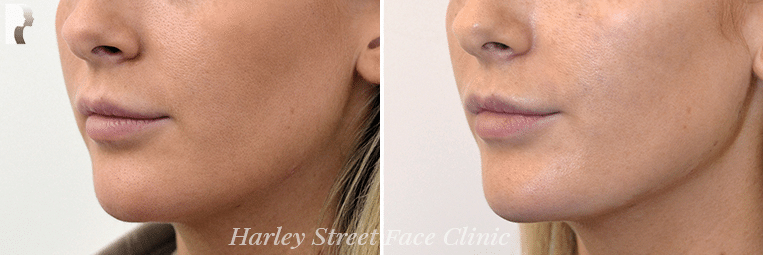 The qualifications and training between a plastic surgeon and a cosmetic surgeon differ.