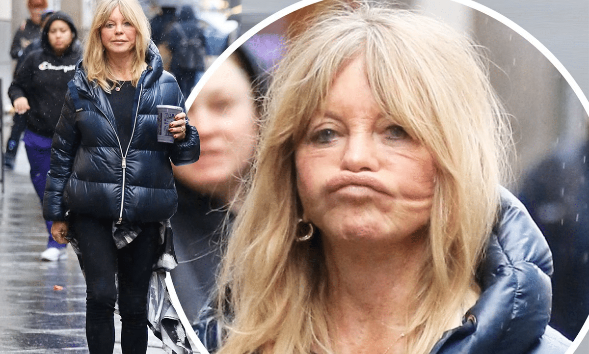 Goldie Hawn's facelift procedure aimed to rejuvenate her appearance.