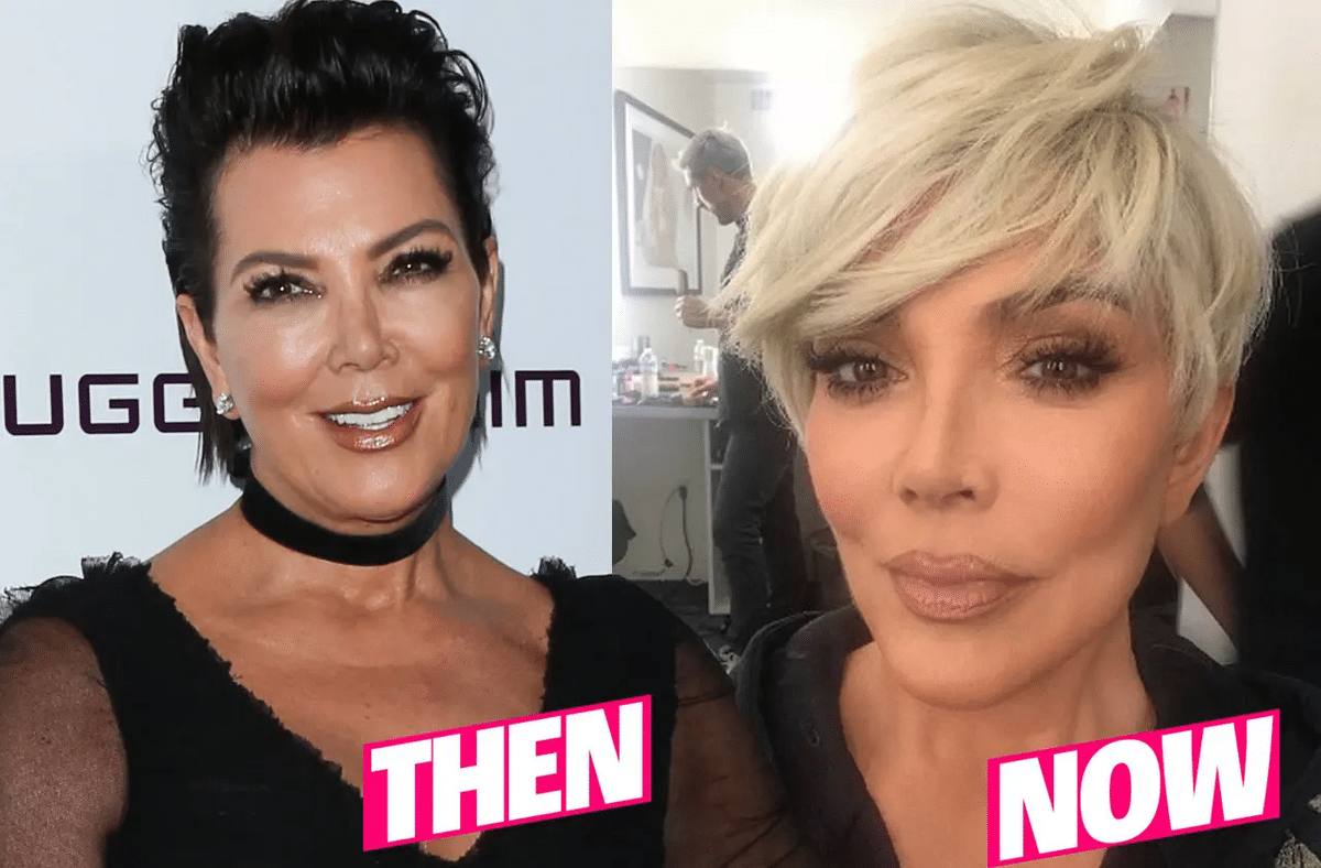 The momager extraordinaire famously underwent facelift years back to address ageing and Kim calling her “gobble gobble”. 