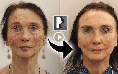 Three Key Signs To Know If You’re Ready for A Facelift