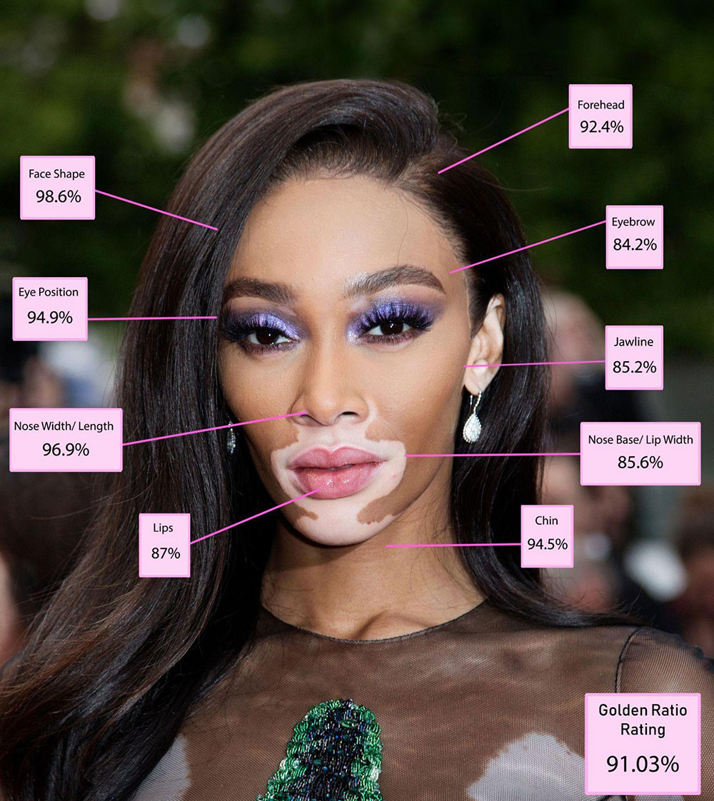 Winnie Harlow - face analysis